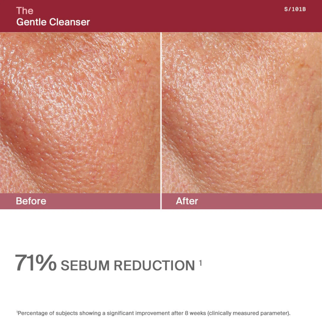 AWvi The Gentle Cleanser - Image 8