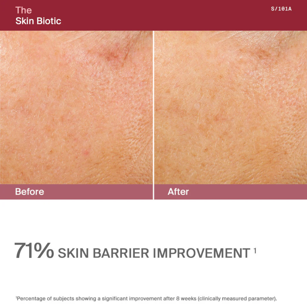 AWvi The Skin Biotic - Image 7