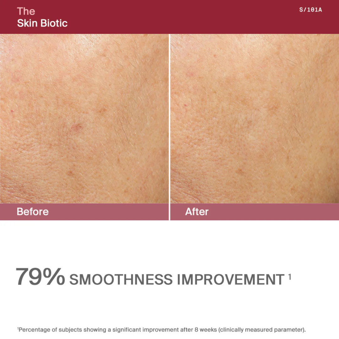 AWvi The Skin Biotic - Image 8