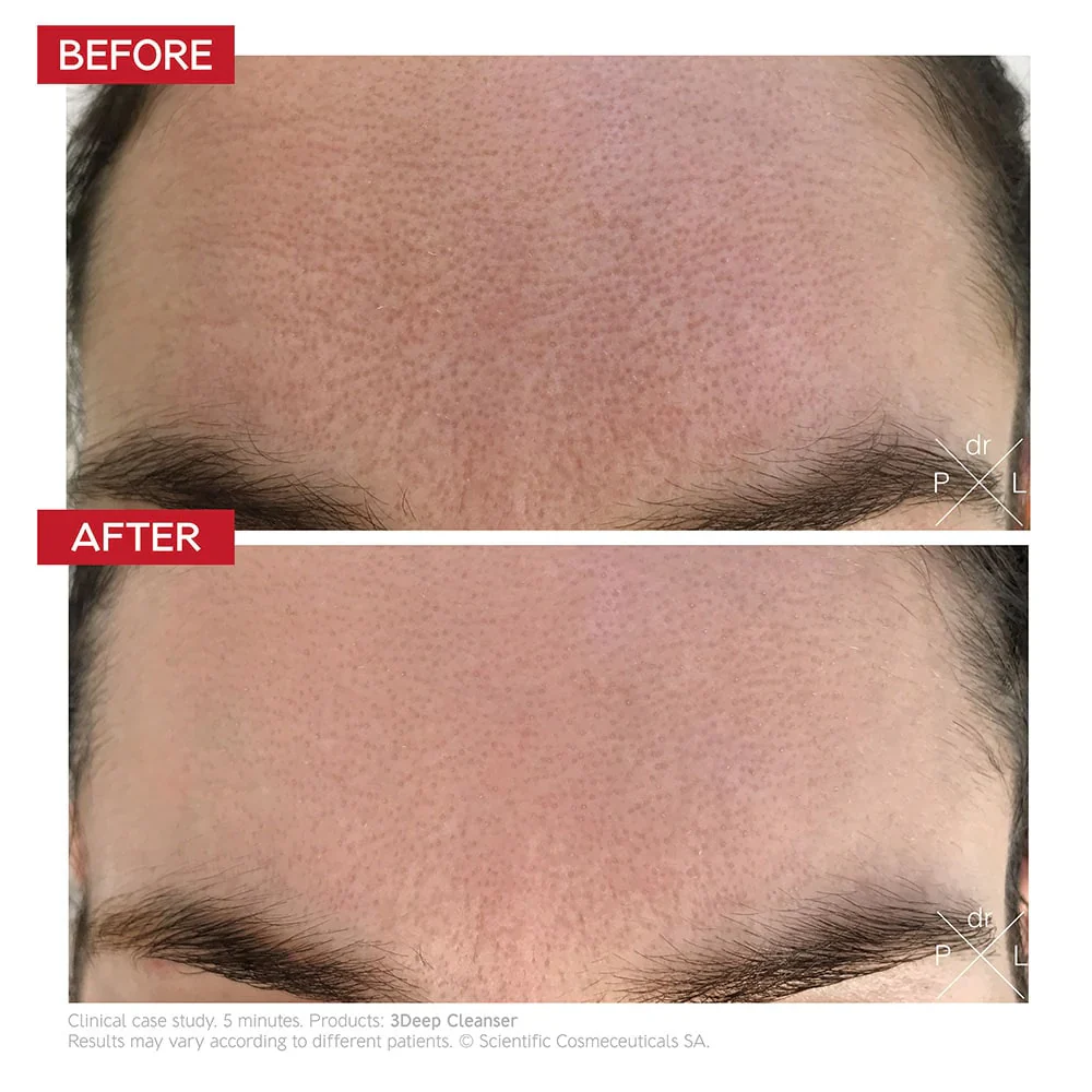Dr. LEVY Switzerland 3DEEP™ Cell Renewal Micro-Resurfacing Cleanser - Image 5