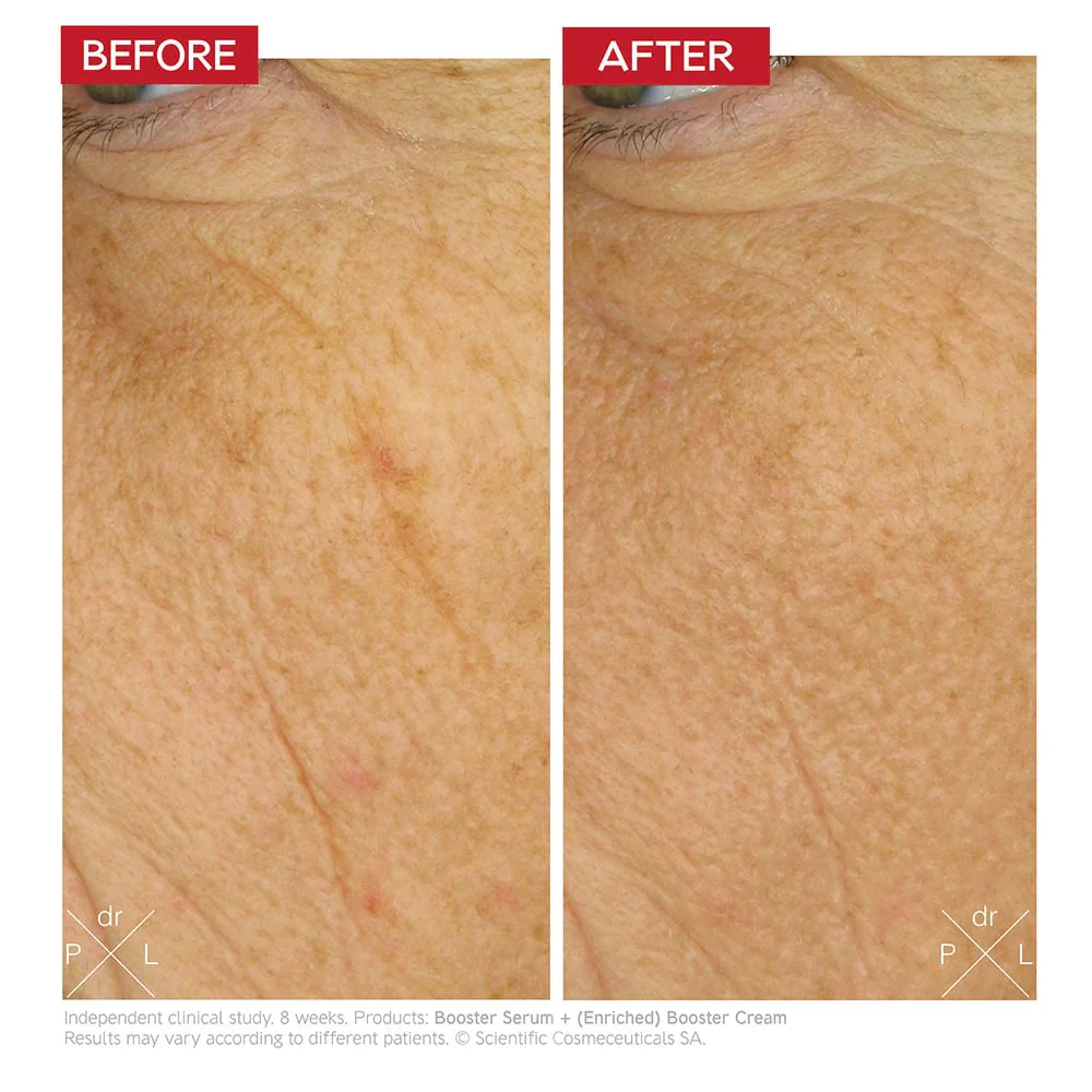 Dr. LEVY Switzerland Enriched Booster Cream - Image 5