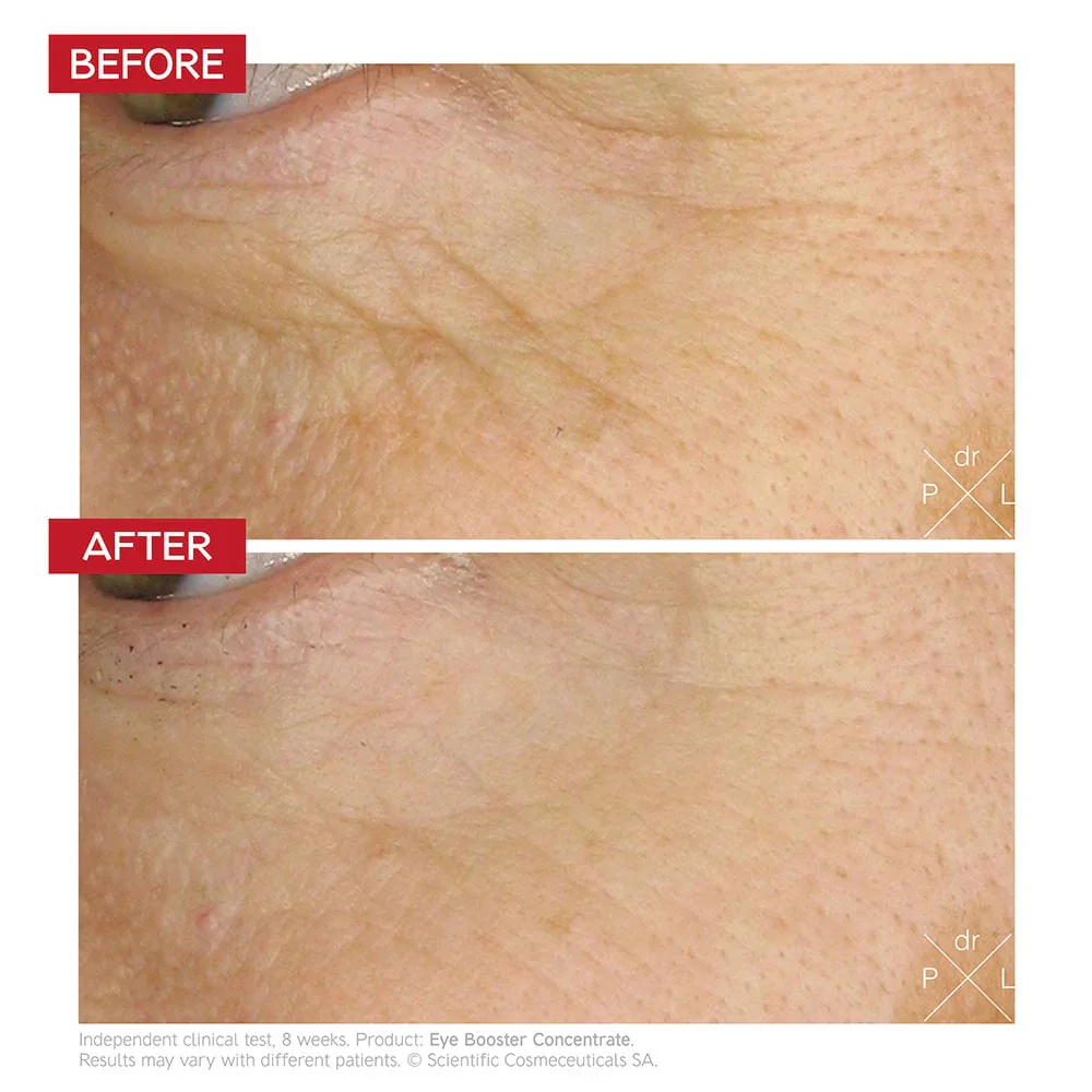 Dr. LEVY Switzerland Eye Booster Concentrate - Image 5