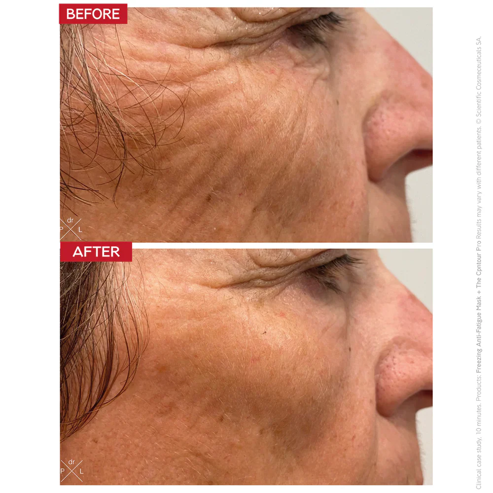 Dr. LEVY Switzerland The Contour Pro - Image 5