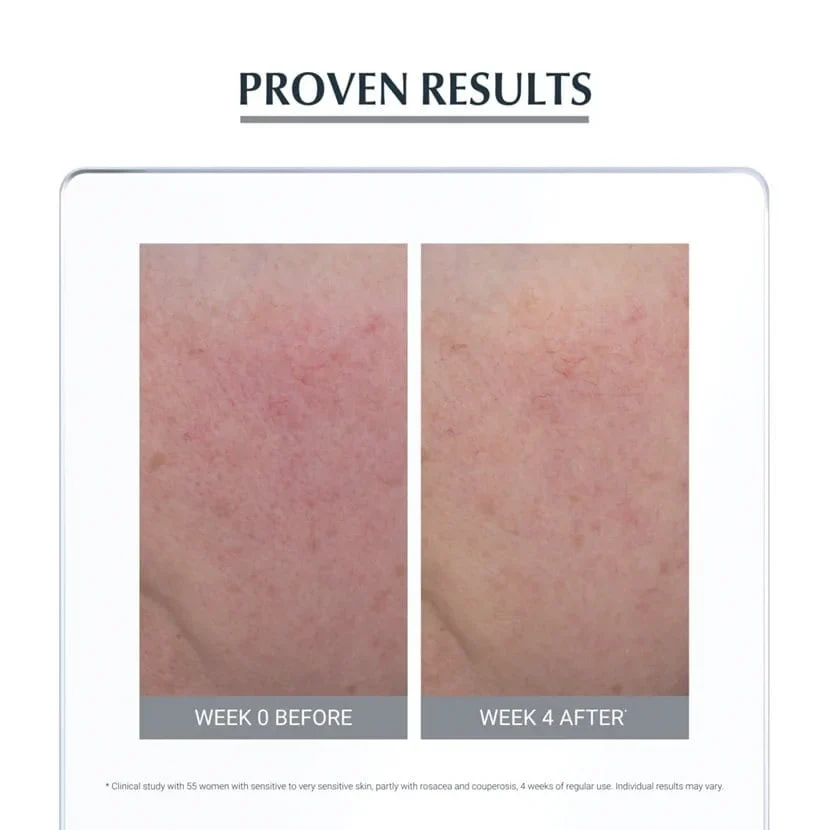 Eucerin AntiRedness Soothing Care - Image 5