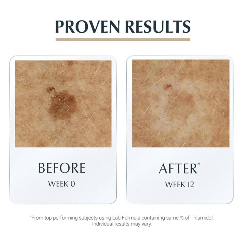 Eucerin Hyaluron-Filler + Elasticity 3D Serum - Image 6